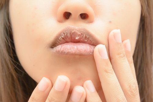 唇の皮がむける原因