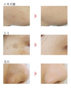 気になるシミを自然にカバー 40代女性が使いたいシミ隠しにおすすめのファンデーションとは Beauty Column 美容コラム Meiko